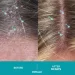  Ds Laboratories Dandrene Anti Dandruff Conditioner    205  (4384307117)