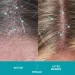  Ds Laboratories Dandrene Anti Dandruff Shampoo    205  (4384307116)