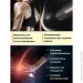 Fascial Gun     Massage Gun 720    