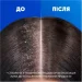 Шампунь Head & Shoulders «Цитрусовая свежесть» 2в1 330 мл (8700216304733) Шампунь Head & Shoulders «Цитрусовая свежесть» 2в1 330 мл (8700216304733)