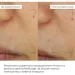     ReNuAge Daily Anti-Aging Care Complex Hillary (2314994276395)