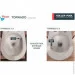  Koller Pool ROUND Smart Tornado 3.0   Soft Close (RN-0490-RQ3)