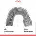 Opro  Silver  ( 11+ ) Clear (art.102502006)