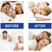           Sleep Strips  񳺿  30  053